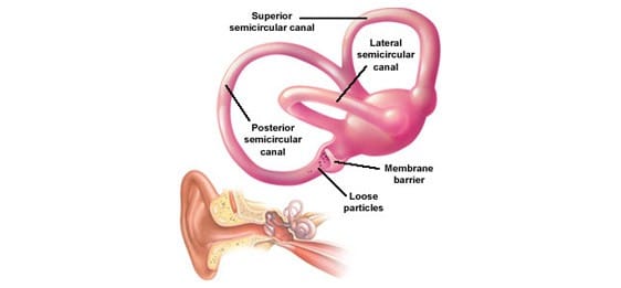 positional-vertigo-south-city-physiotherapy